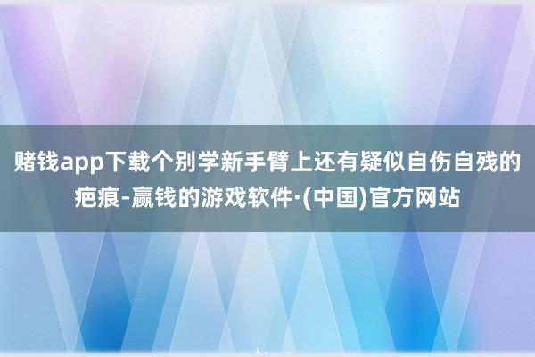 赌钱app下载个别学新手臂上还有疑似自伤自残的疤痕-赢钱的游戏软件·(中国)官方网站